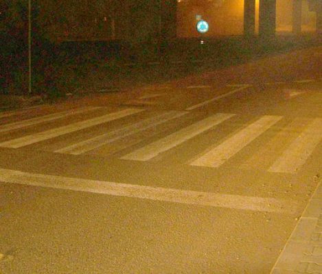 Accidentată pe trecerea de pietoni, în dreptul hotelului Dobrogea
